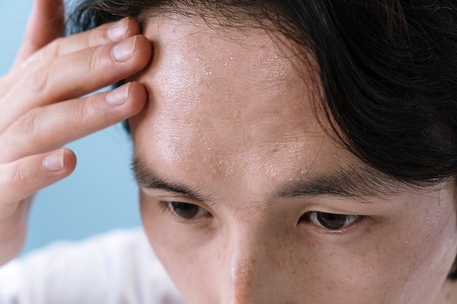 effects of stress on skin and hair